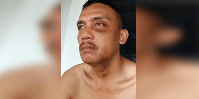 Saling Lapor Oknum Anggota Polri Bersama Ibu Kandungnya, Sedang dalam Proses Satreskrim Polres Binjai